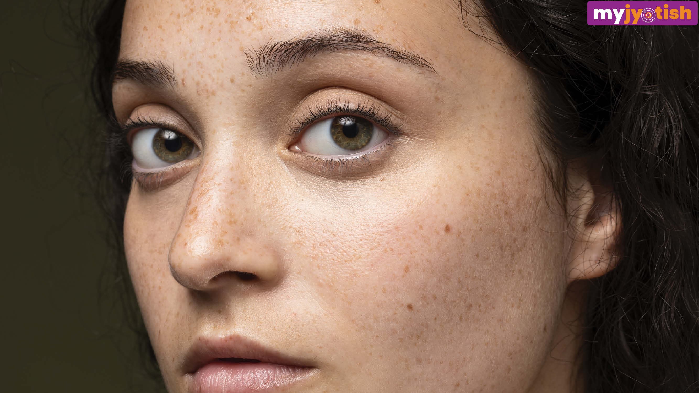 Moles on Face: चेहरे के इन अंगों पर तिल होने से व्यक्ति होता है लकी, खूब कमाते हैं धन